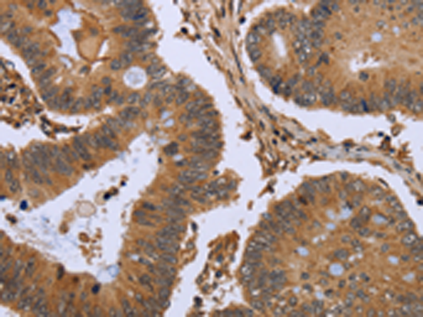 Anti-FHL2 Rabbit Polyclonal Antibody