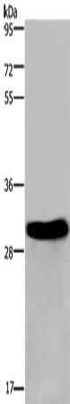 Anti-FHL2 Rabbit Polyclonal Antibody