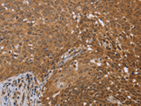 Anti-FKBP38 Rabbit Polyclonal Antibody