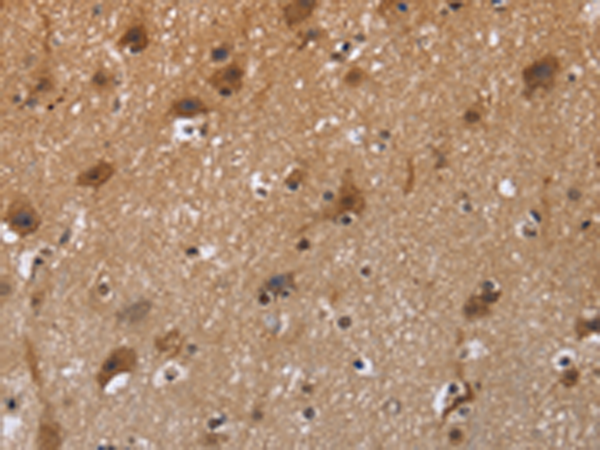 Anti-FSTL1 Rabbit Polyclonal Antibody