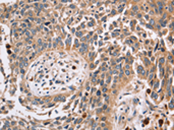 Anti-FUCA1 Rabbit Polyclonal Antibody