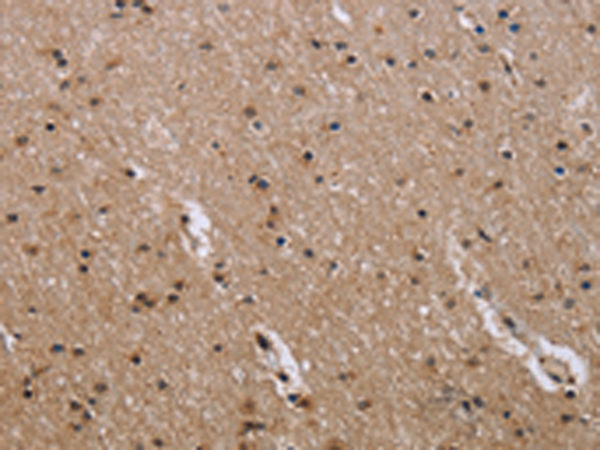Anti-GAB2 Rabbit Polyclonal Antibody