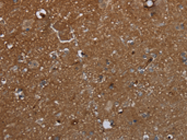 Anti-GALT Rabbit Polyclonal Antibody