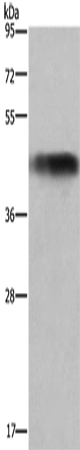 Anti-GALT Rabbit Polyclonal Antibody