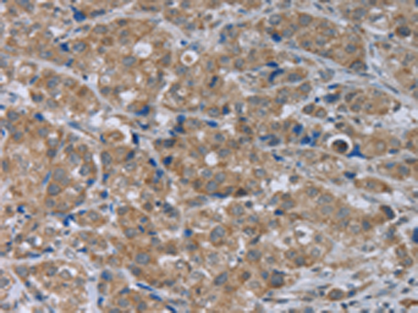 Anti-GABA A Receptor beta 1 Rabbit Polyclonal Antibody