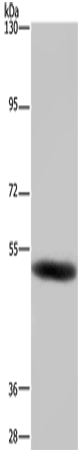 Anti-GABA A Receptor beta 1 Rabbit Polyclonal Antibody