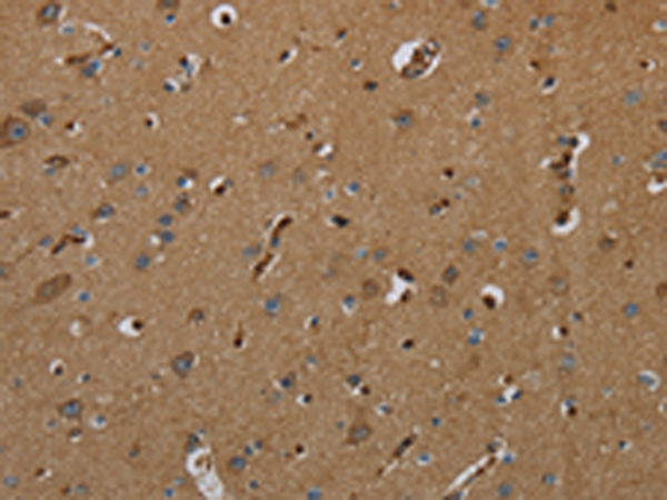 Anti-GBP5 Rabbit Polyclonal Antibody