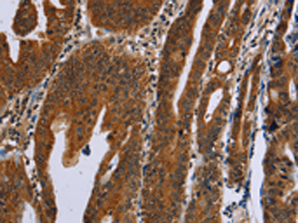 Anti-Growth Hormone 2 Rabbit Polyclonal Antibody