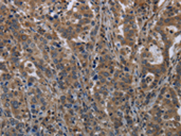 Anti-TSC22D3 Rabbit Polyclonal Antibody