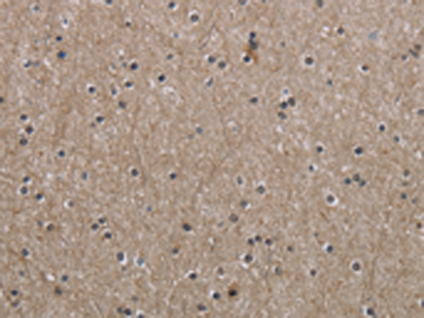 Anti-COASY Rabbit Polyclonal Antibody
