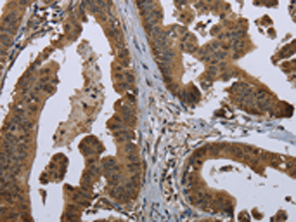 Anti-GM130 Rabbit Polyclonal Antibody