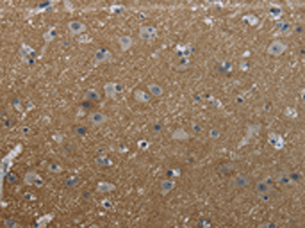 Anti-GNG2 Rabbit Polyclonal Antibody