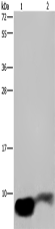 Anti-GNG2 Rabbit Polyclonal Antibody