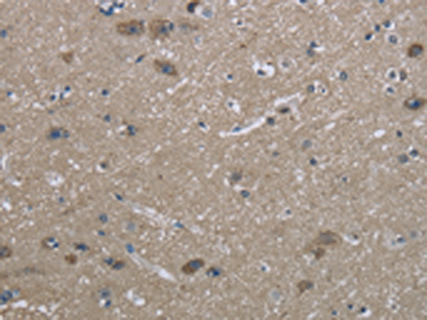 Anti-GRP75 Rabbit Polyclonal Antibody