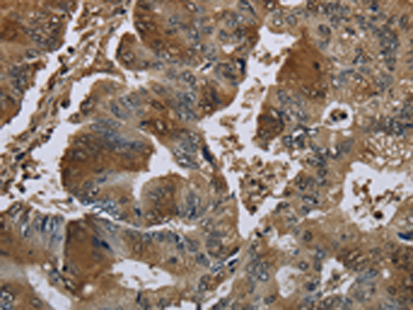 Anti-GSTO1 Rabbit Polyclonal Antibody