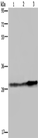 Anti-GSTO1 Rabbit Polyclonal Antibody