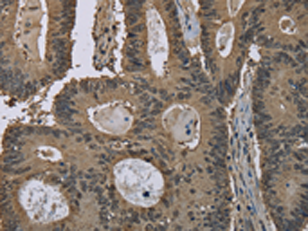 Anti-GST3 Rabbit Polyclonal Antibody