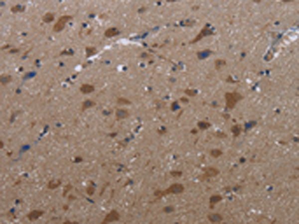Anti-LETMD1 Rabbit Polyclonal Antibody