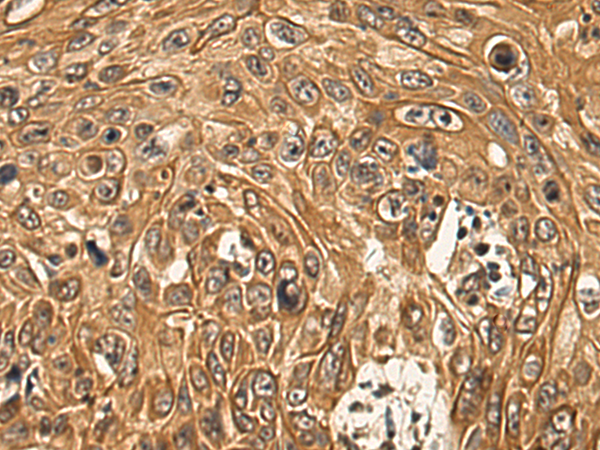 Anti-LIPC Rabbit Polyclonal Antibody