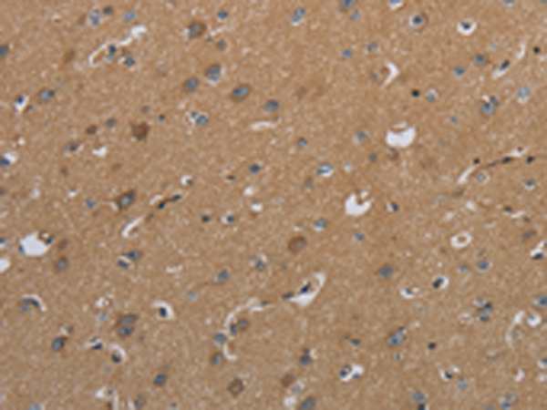 Anti-CSH1 Rabbit Polyclonal Antibody