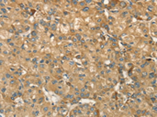 Anti-HSD17B8 Rabbit Polyclonal Antibody