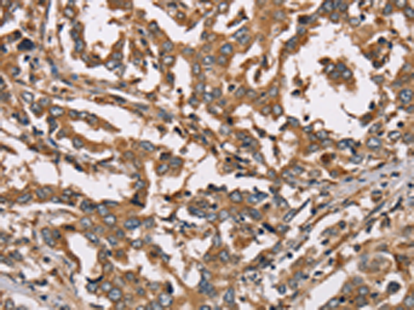 Anti-KAR Rabbit Polyclonal Antibody