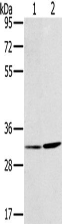 Anti-KAR Rabbit Polyclonal Antibody
