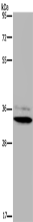 Anti-HSD17B7 Rabbit Polyclonal Antibody