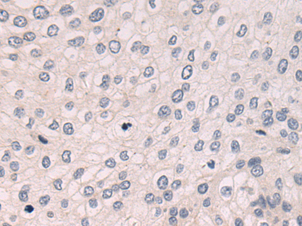 Anti-HSD17B13 Rabbit Polyclonal Antibody