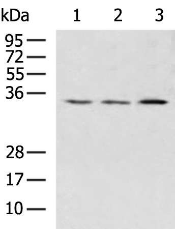 Anti-HSD17B13 Rabbit Polyclonal Antibody