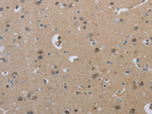 Anti-HSD3B1 Rabbit Polyclonal Antibody