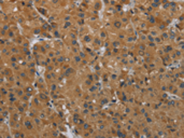Anti-HSD3B7 Rabbit Polyclonal Antibody