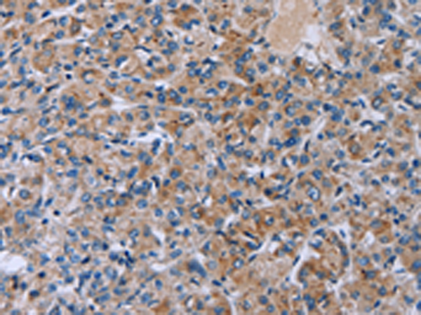 Anti-HSD3B2 Rabbit Polyclonal Antibody