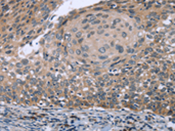 Anti-RNF144B Rabbit Polyclonal Antibody