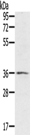 Anti-RNF144B Rabbit Polyclonal Antibody