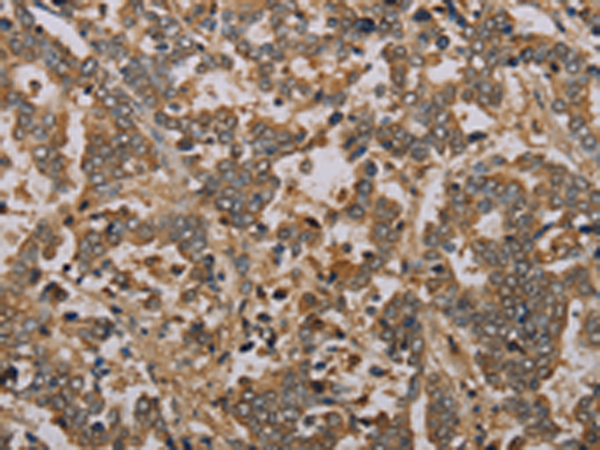 Anti-CCN3 Rabbit Polyclonal Antibody