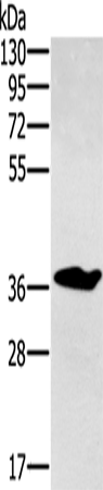 Anti-CCN3 Rabbit Polyclonal Antibody