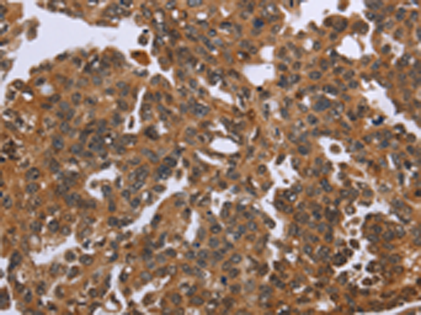Anti-Ihh Rabbit Polyclonal Antibody
