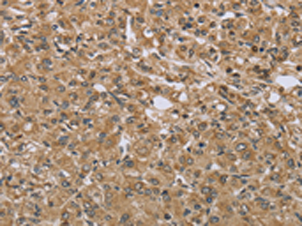 Anti-alpha Taxilin Rabbit Polyclonal Antibody