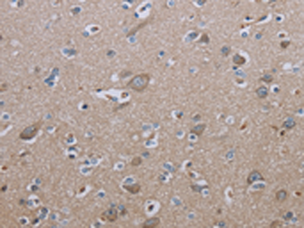 Anti-IL-27 Receptor alpha Rabbit Polyclonal Antibody