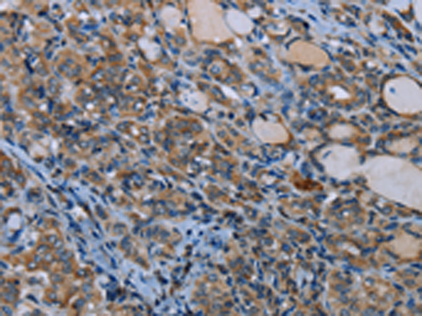 Anti-IL-31 Receptor alpha Rabbit Polyclonal Antibody
