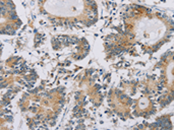 Anti-IPO13 Rabbit Polyclonal Antibody