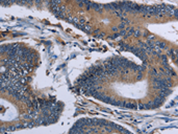 Anti-Importin 4 Rabbit Polyclonal Antibody
