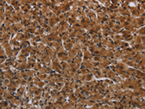 Anti-IRGM Rabbit Polyclonal Antibody