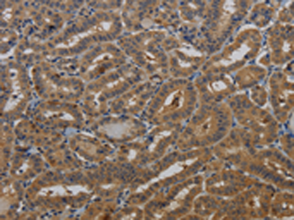 Anti-KCNK17 Rabbit Polyclonal Antibody