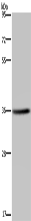 Anti-KCNK17 Rabbit Polyclonal Antibody