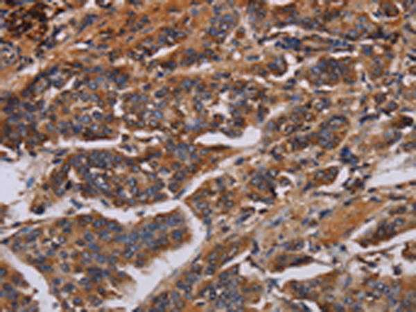 Anti-KCNQ1 Rabbit Polyclonal Antibody