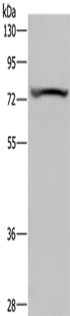 Anti-KCNQ1 Rabbit Polyclonal Antibody