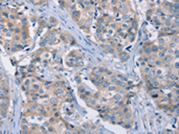 Anti-KCNQ5 Rabbit Polyclonal Antibody