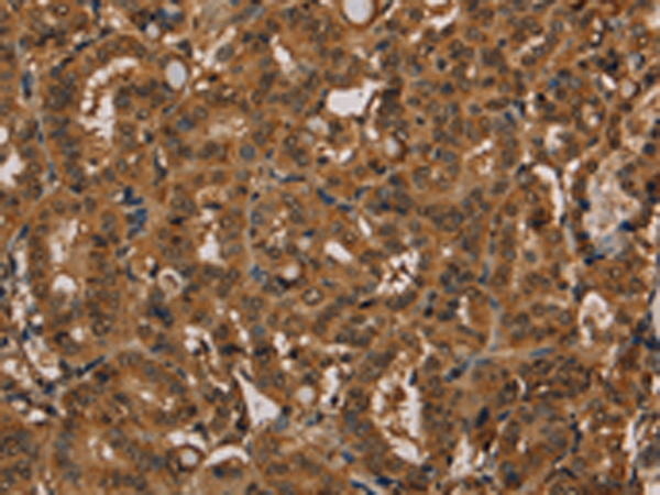 Anti-KIF20A Rabbit Polyclonal Antibody